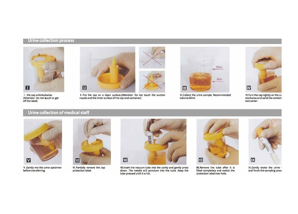 Urine Collection Process